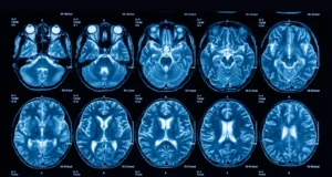 Blindsight : Advanced Techniques In Red Teaming And LSASS Memory Exploitation