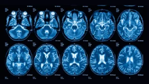 Blindsight : Advanced Techniques In Red Teaming And LSASS Memory Exploitation